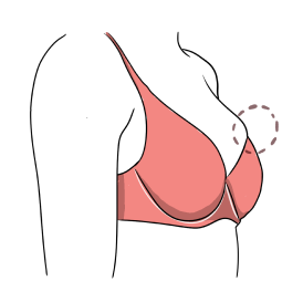 Fitting 1